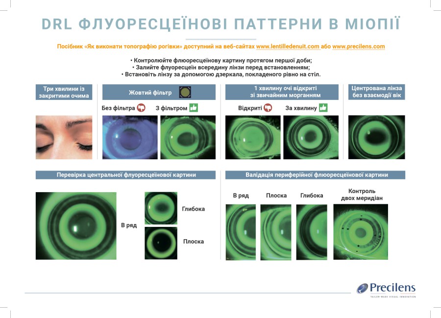 DRL флуоресцеїнові патерни в міопії