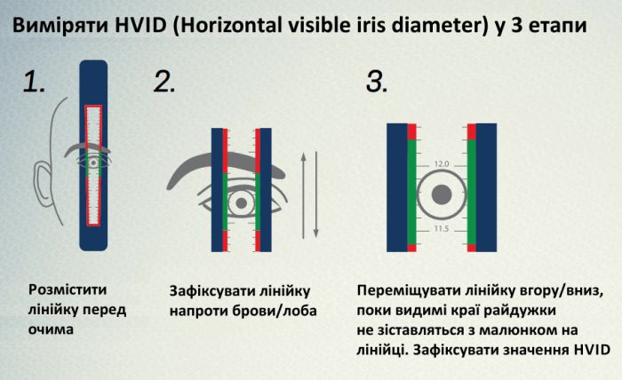 Виміряти HVID (Horizontal visible iris diameter) у 3 етапи